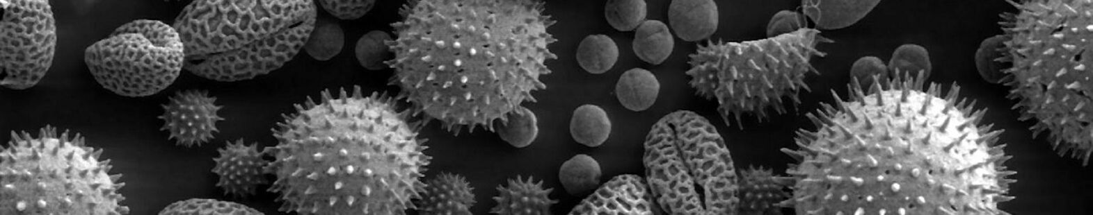 Microscopic image of different kinds of pollen. Some are small and round, others are larger and with spikes.